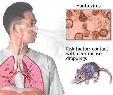 hantavirus_pulmonary.jpg