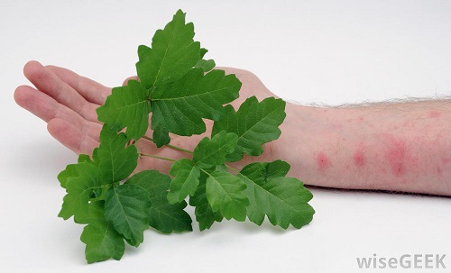 rash-and-green-leafs.jpg